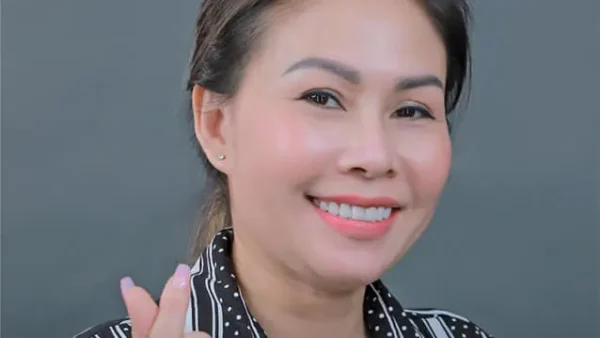 Công dụng của phương pháp hàn răng tạm thời