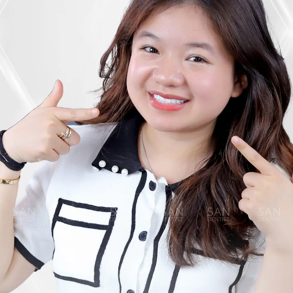 Kem đánh răng nào có thể điều trị cao răng?