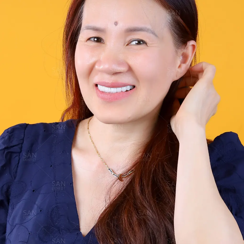 Kem đánh răng nào có thể điều trị cao răng?