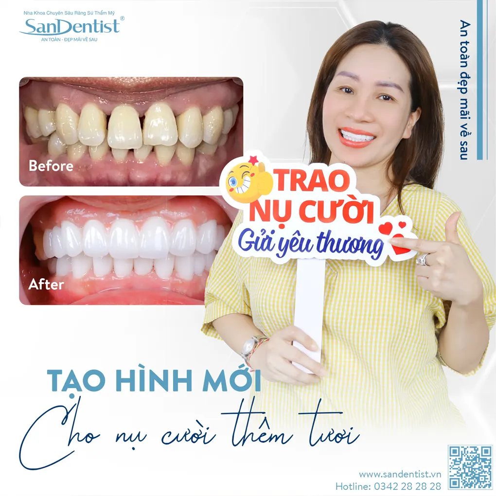 Tại sao nên trồng răng sứ?