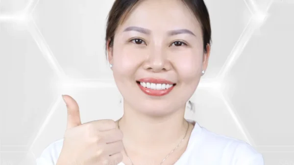 Viêm lợi tụt lợi Nguyên nhân và cách điều trị
