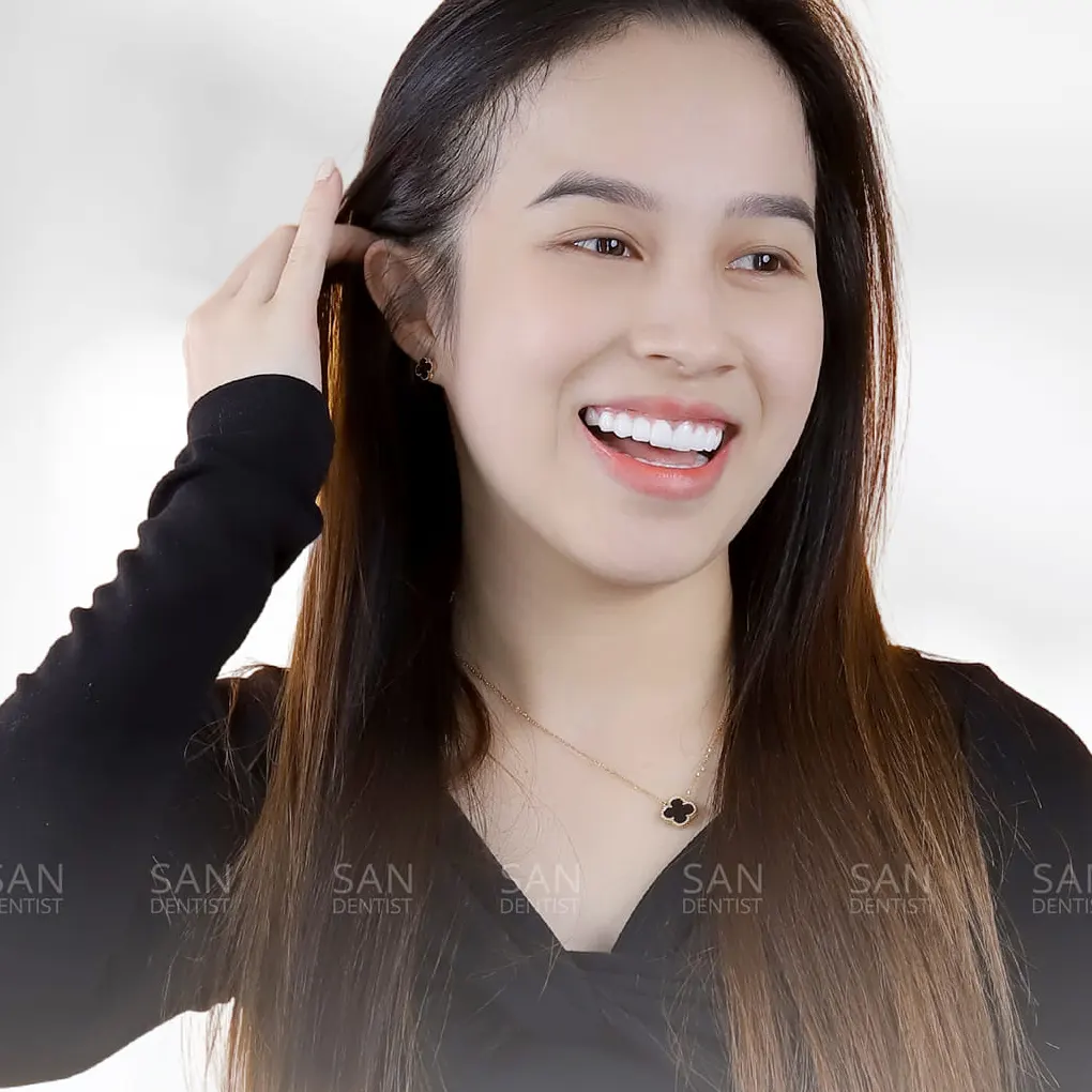 Viêm lợi tụt lợi Nguyên nhân và cách điều trị