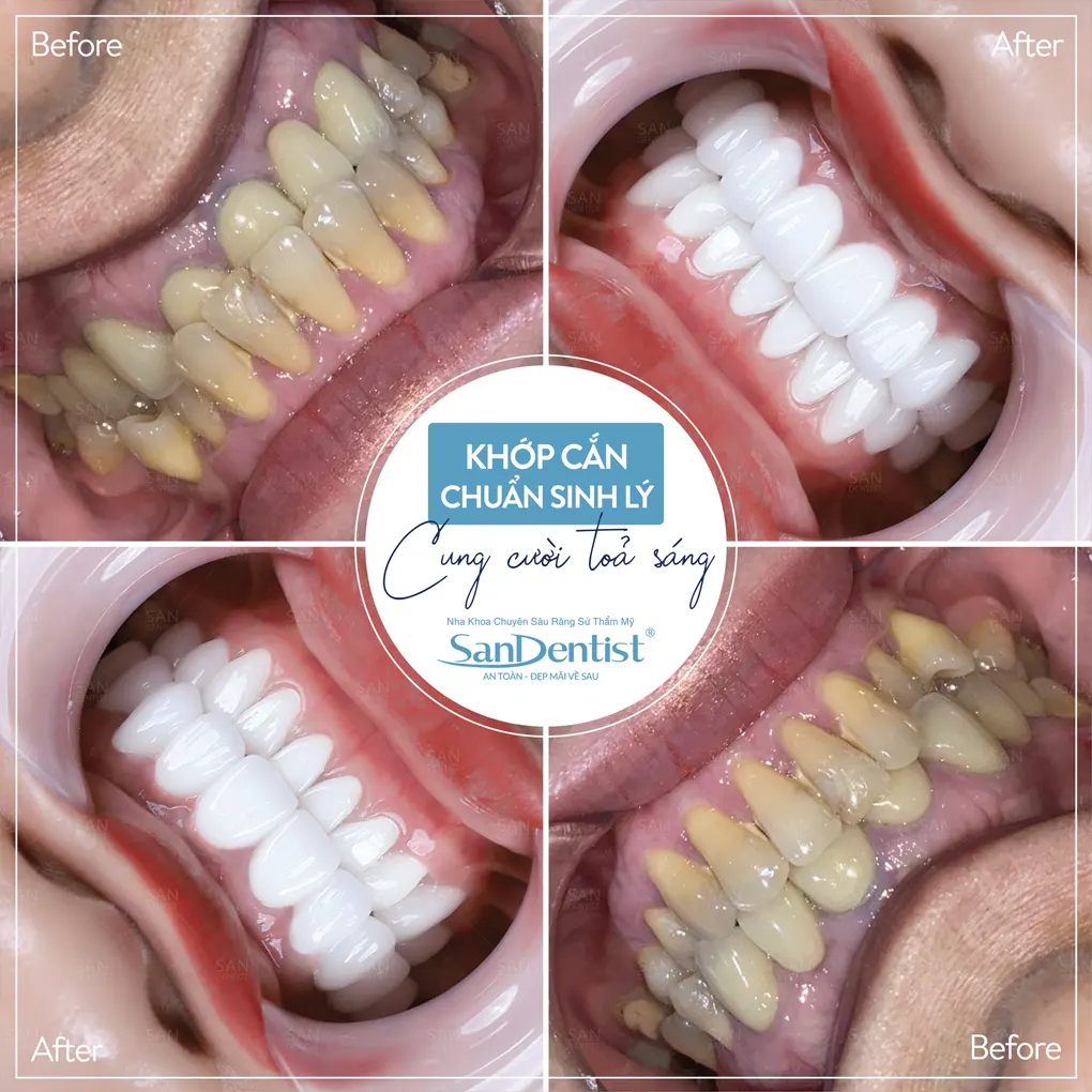 10 bí quyết chăm sóc răng miệng đúng cách