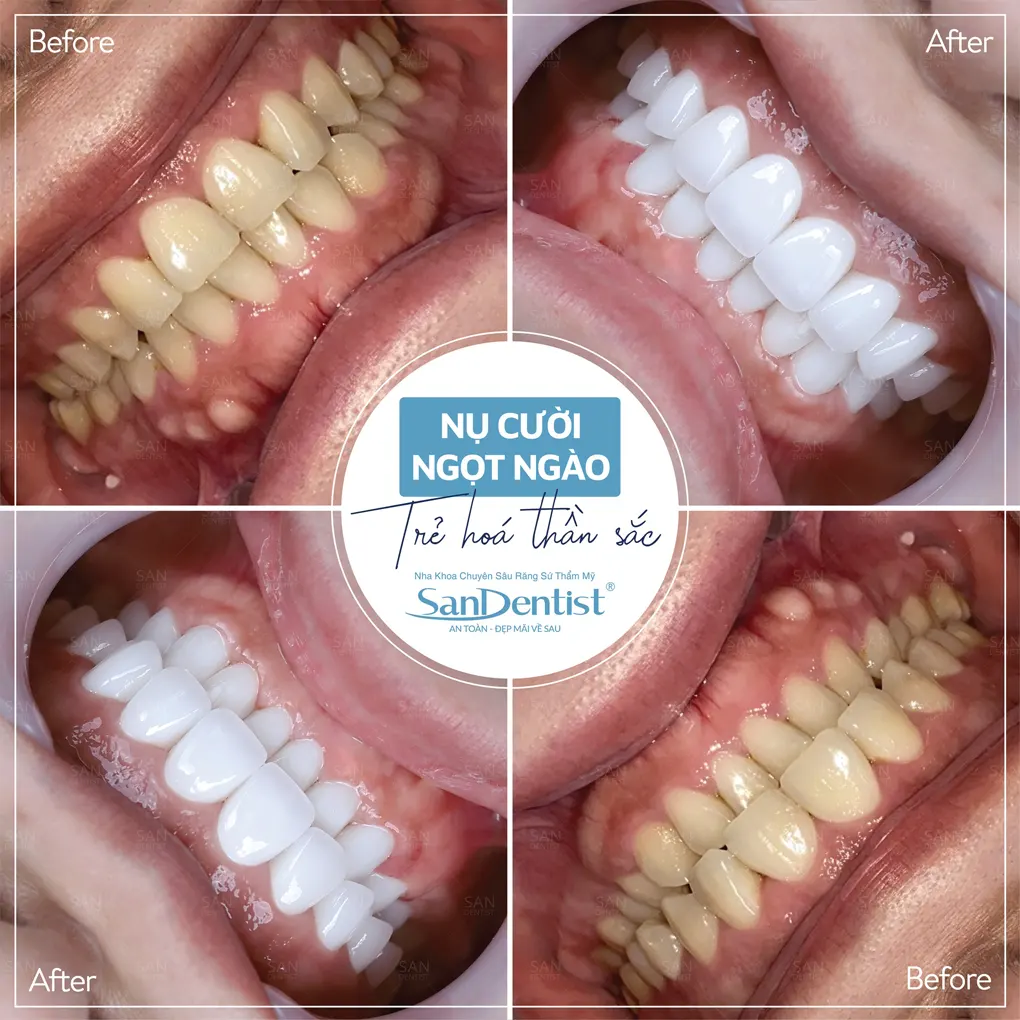 3 cách cải thiện tình trạng hơi thở có mùi