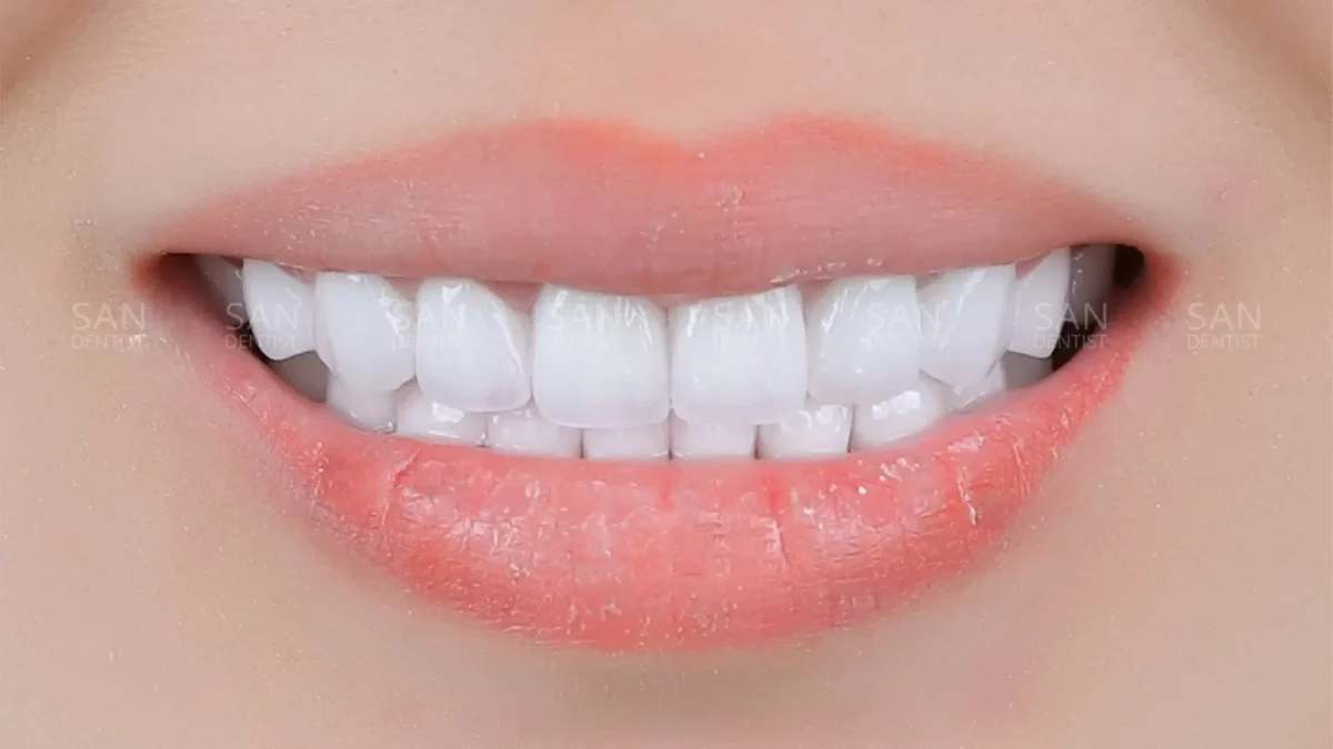 7 vấn đề răng miệng phổ biến nhất