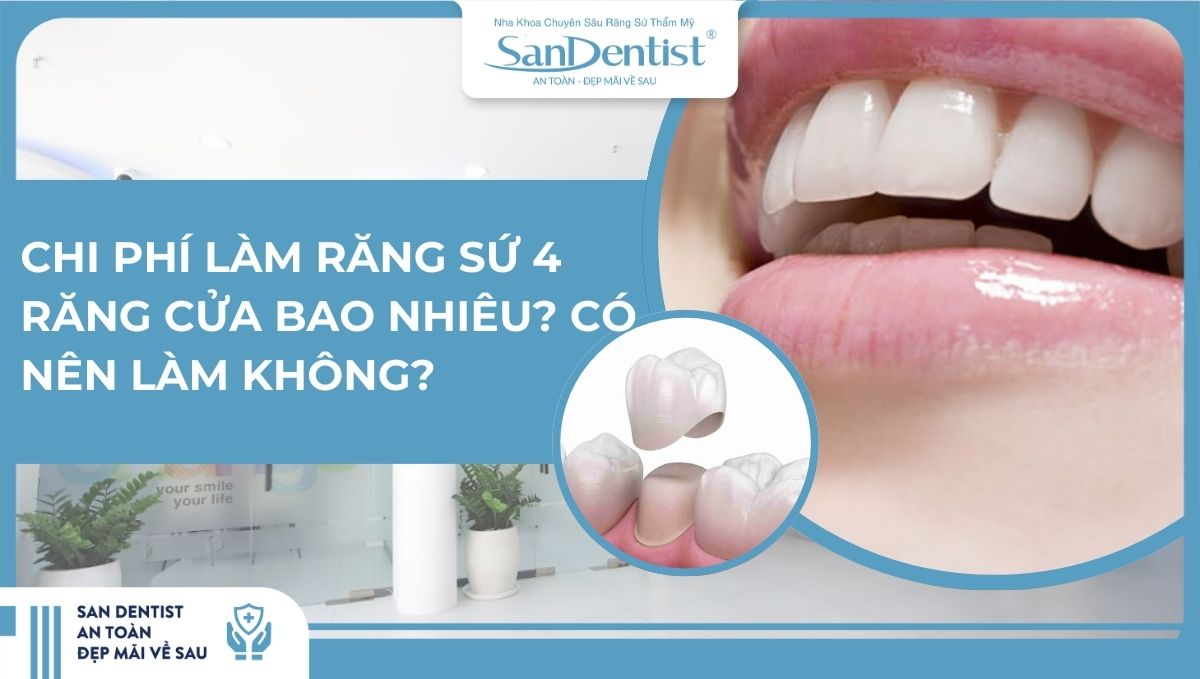 Chi phí làm răng sứ 4 răng cửa bao nhiêu_ Có nên làm không