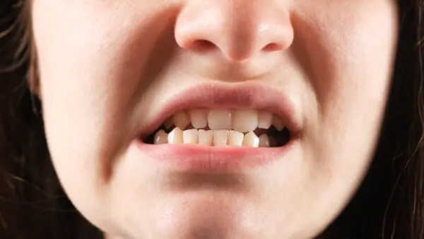 Dấu hiệu và cách điều trị tình trạng trật khớp hàm