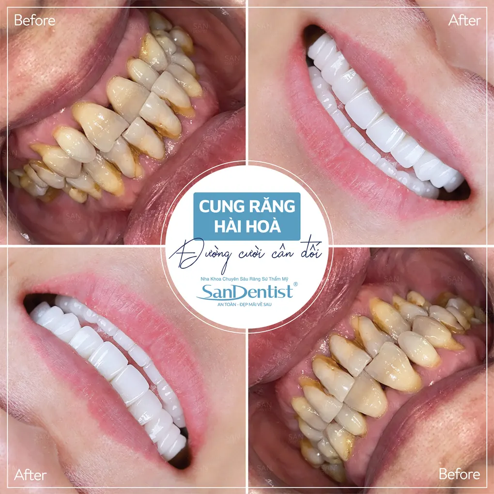 Đau quai hàm: Nguyên nhân và cách điều trị