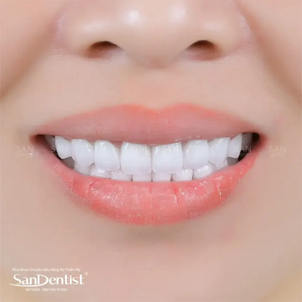 Dưa leo có điều trị được tình trạng hôi miệng?