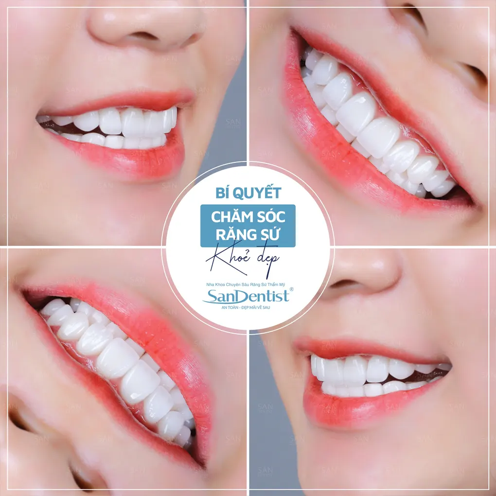 Những nguy cơ khi điều trị cao răng tại nhà