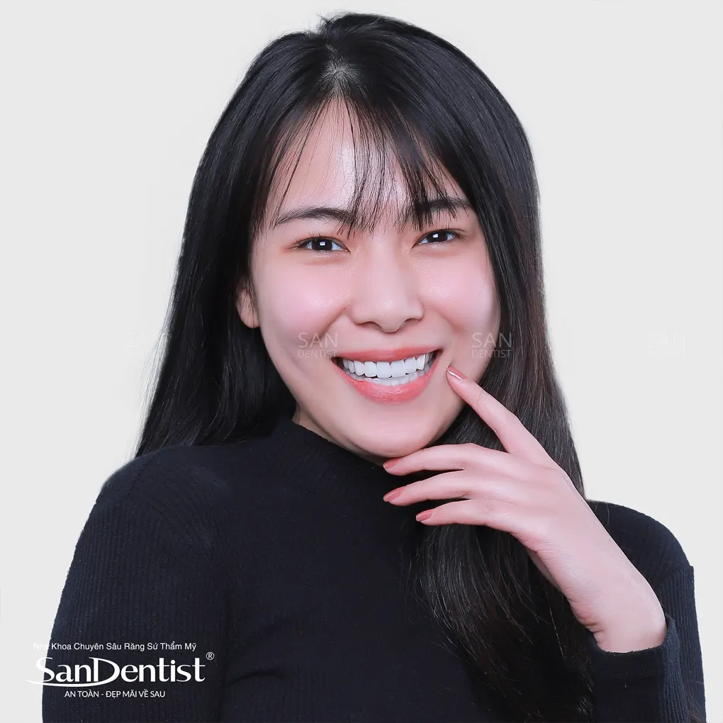 Cách lựa chọn màu sắc của răng sứ