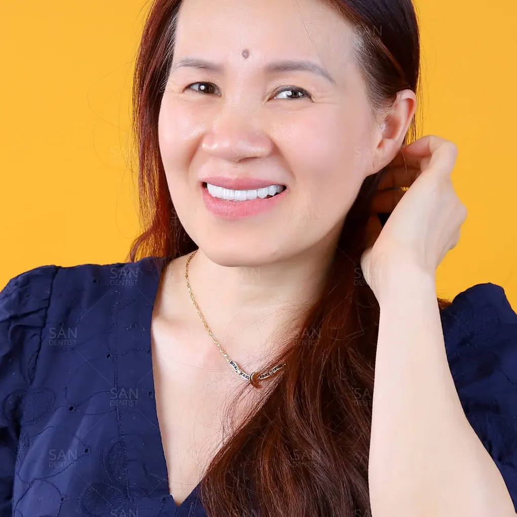 Cách xử lý tình trạng ngứa nướu răng lâu ngày