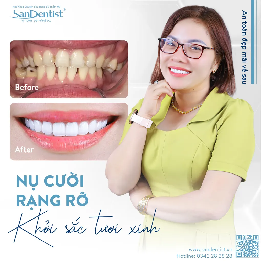 Những điều cần biết về tình trạng răng bị đen