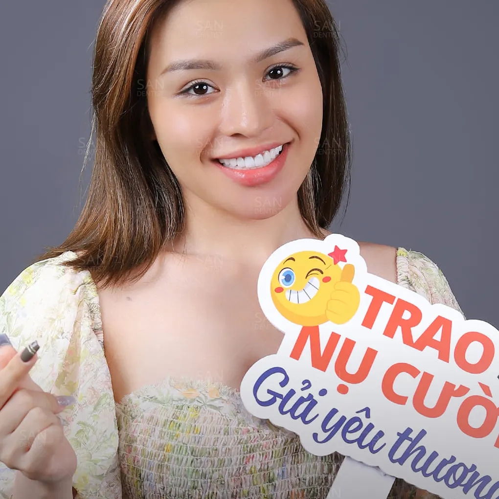 Phẫu thuật cười hở lợi khoảng bao nhiêu tiền?