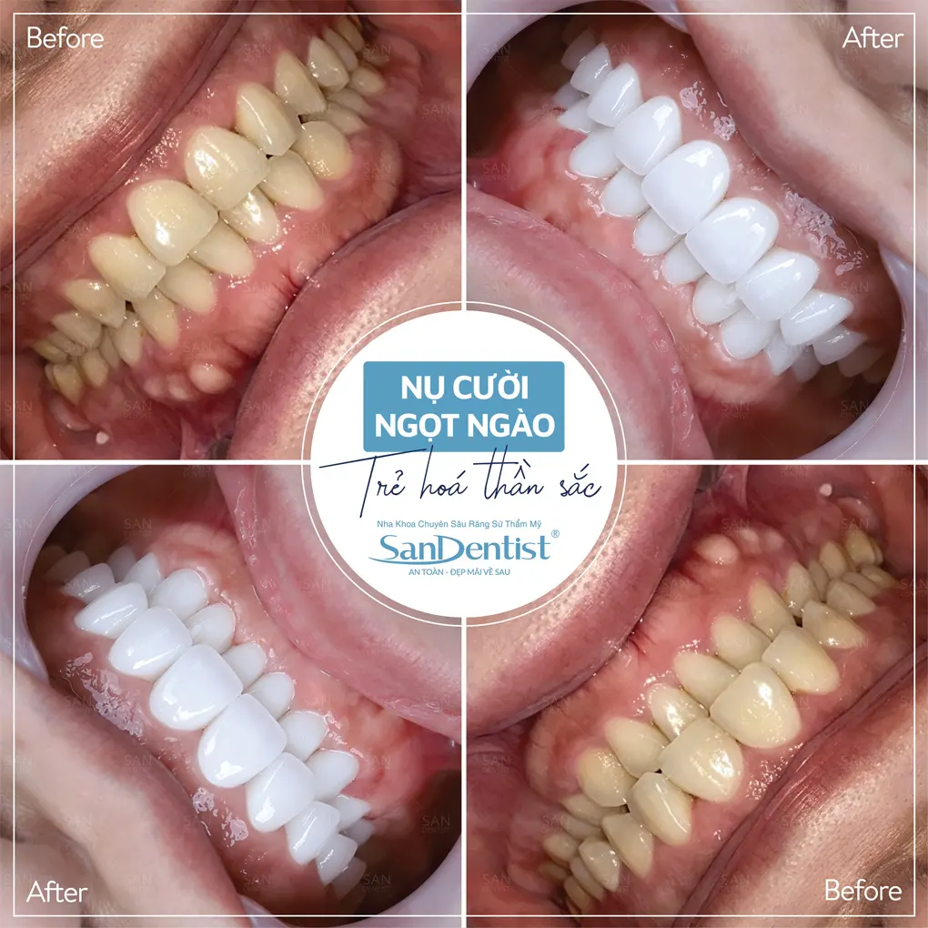 Quản lý thói quen thường ngày khi cai thuốc lá