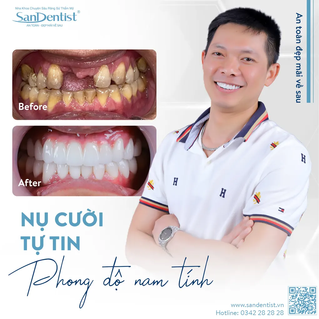 Quản lý thói quen thường ngày khi cai thuốc lá