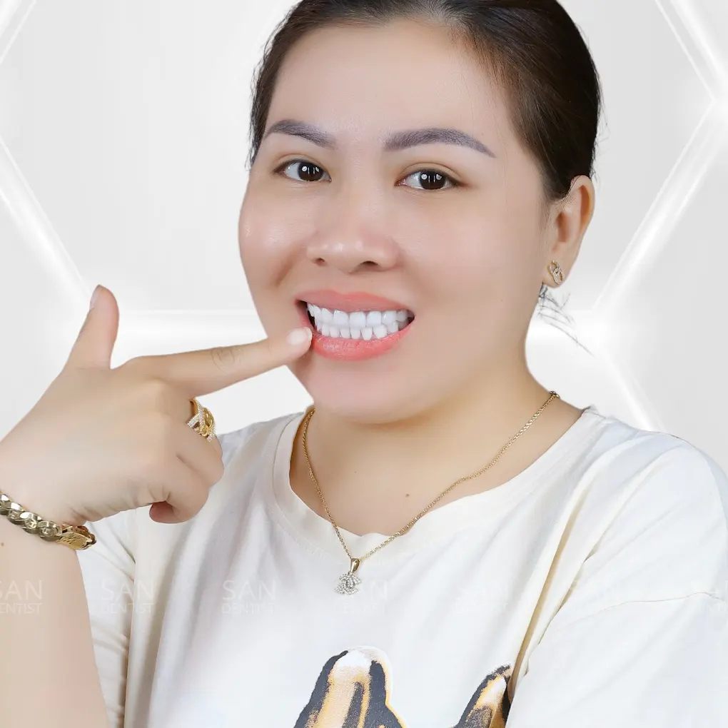 Tẩy trắng răng có làm răng bị nhạy cảm? 