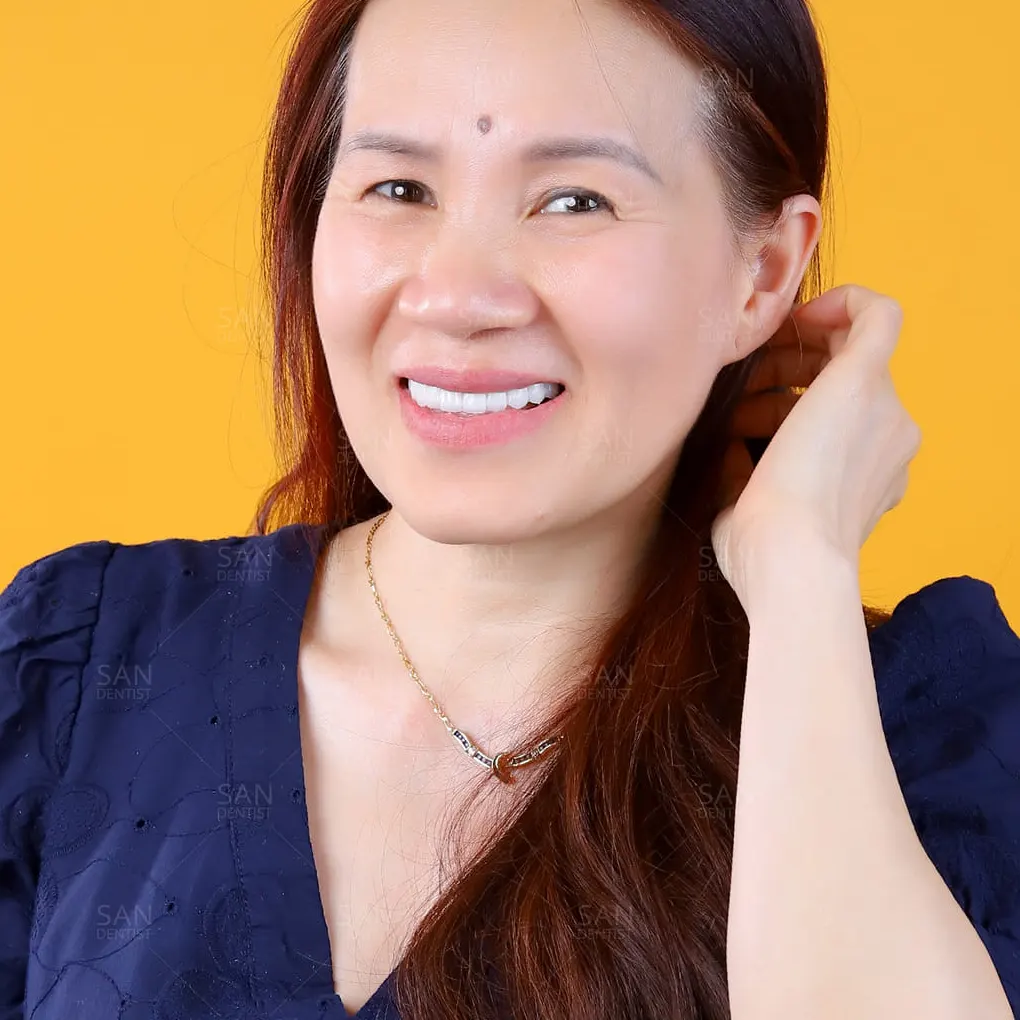 3 vấn đề răng miệng ở người già