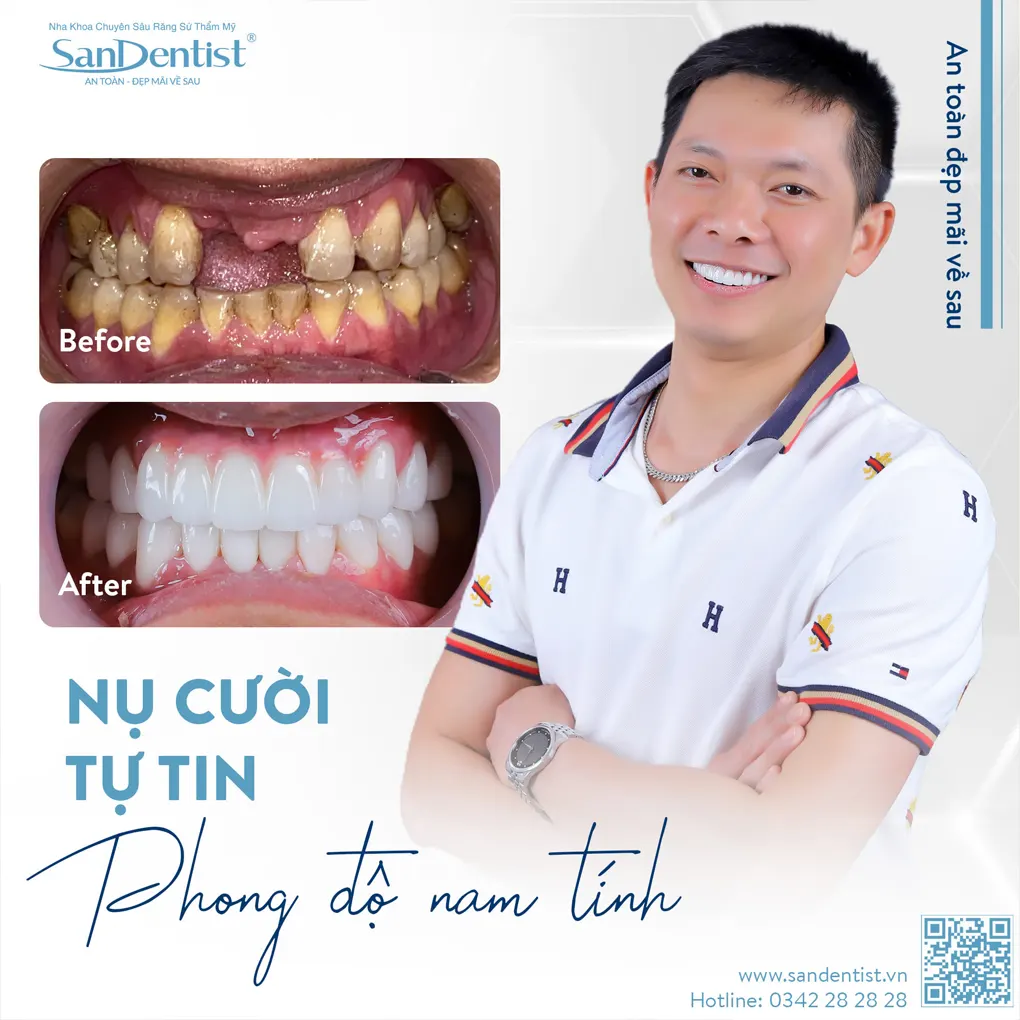 5 lưu ý khi người cao tuổi muốn trồng răng