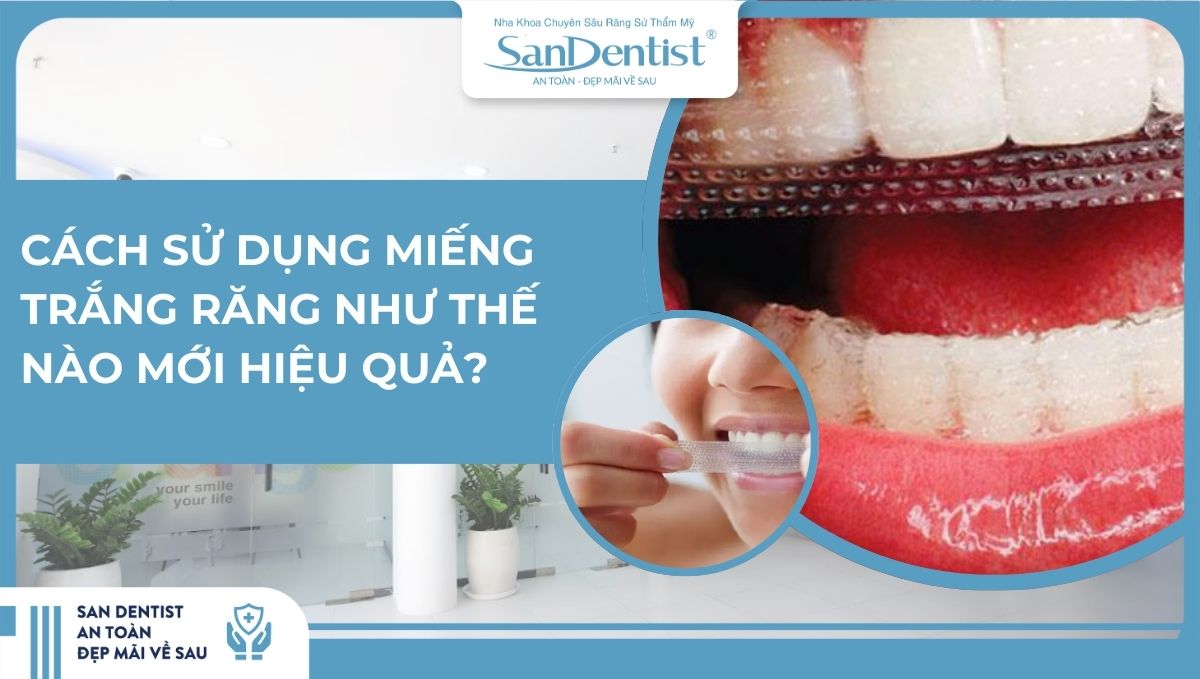 Cách sử dụng miếng dán trắng răng như thế nào mới hiệu quả