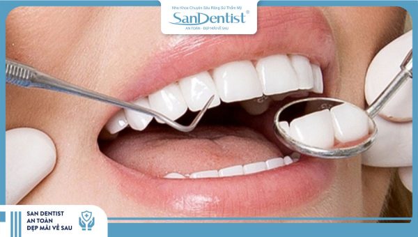 Có nên làm răng sứ không