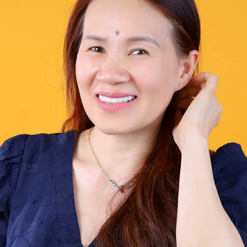 Bỏ túi ngay 4 mẹo cầm máu sau nhổ răng