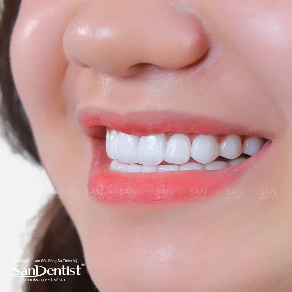 Đeo khẩu trang có gây hại cho răng miệng?