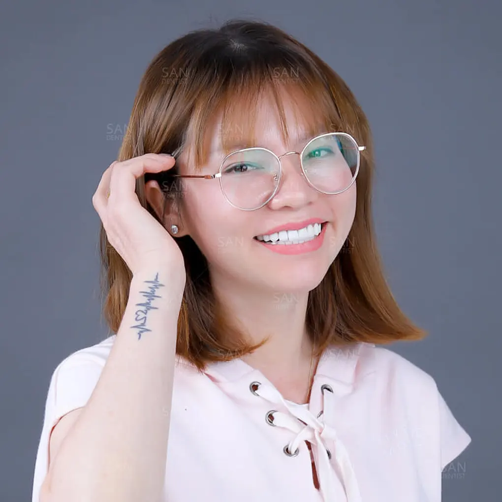 Điểm mặt những thói quen khiến răng bị ố vàng