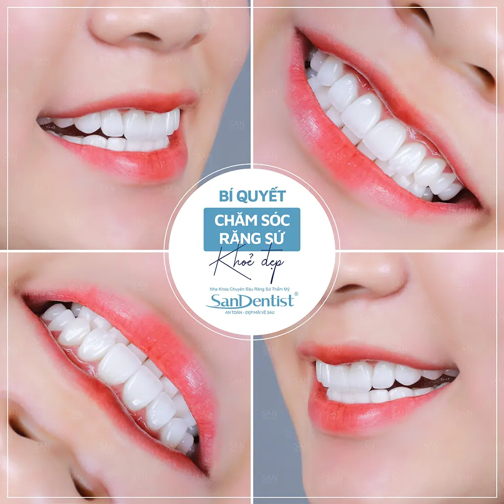 Phương pháp hàn cổ răng: Ưu và nhược điểm