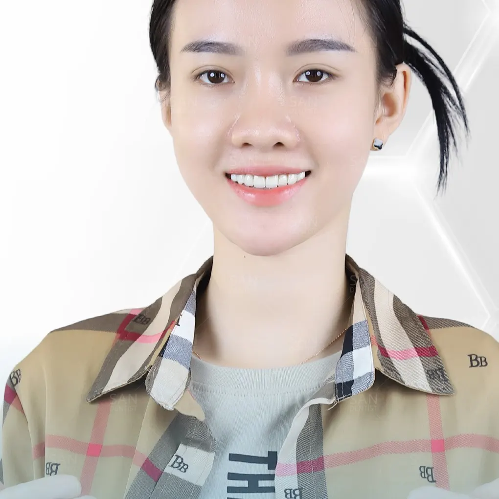 Răng bị mục: Nguyên nhân và cách khắc phục