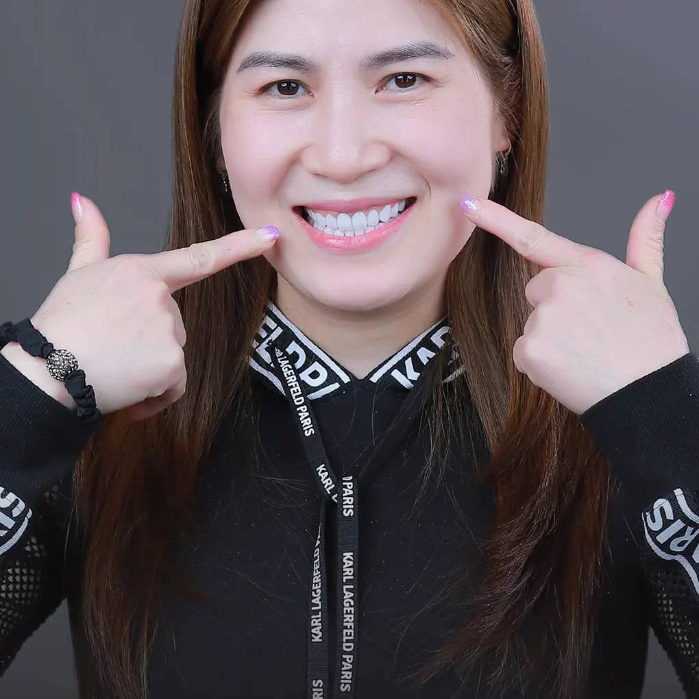 Răng khôn bị sâu cần xử lý như thế nào?