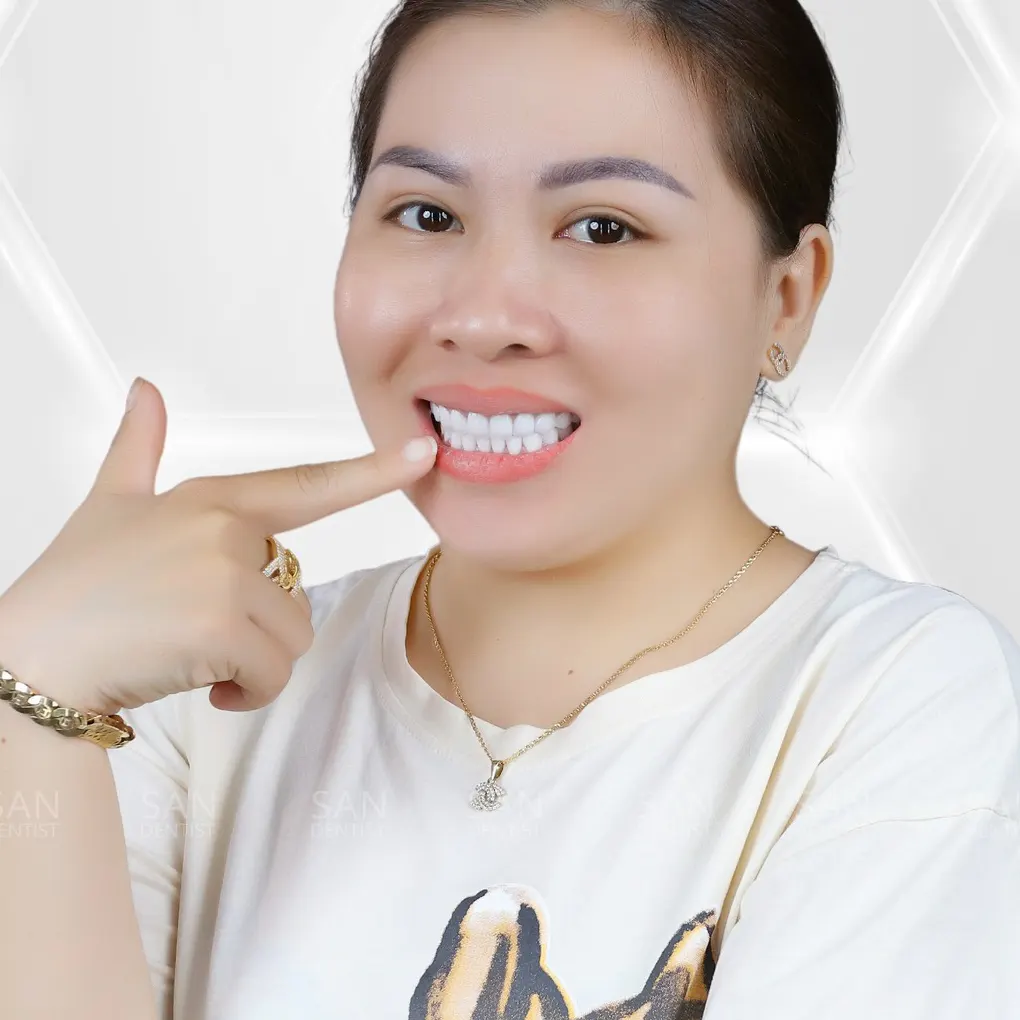 Tại sao kem đánh răng dược liệu được ưa chuộng?