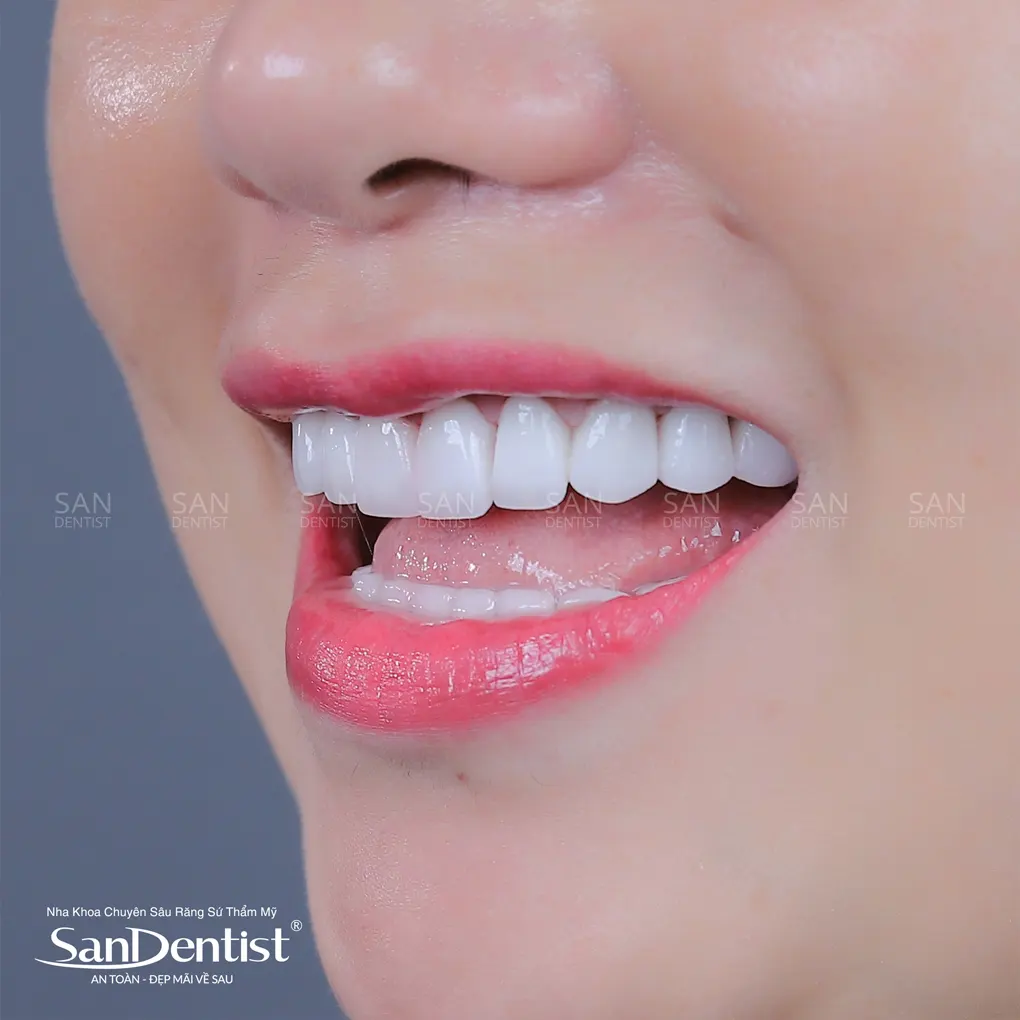 Thời điểm nên thay bàn chải đánh răng mới?