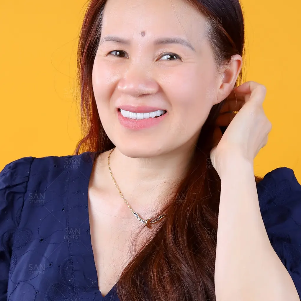 Tiêu xương ổ răng cần được xử lý như thế nào?