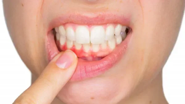 Tìm hiểu ngay các bệnh lý về răng