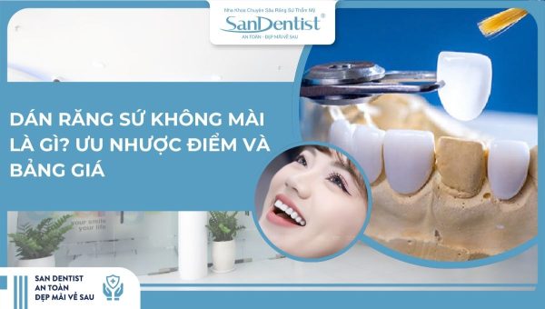 Dán răng sứ không mài là gì_ Ưu nhược điểm và bảng giá