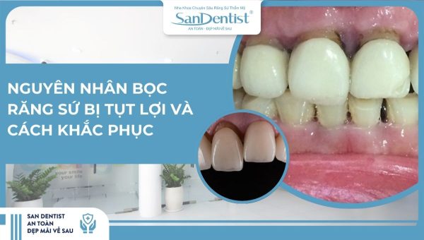 Nguyên nhân bọc răng sứ bị tụt lợi và cách khắc phục