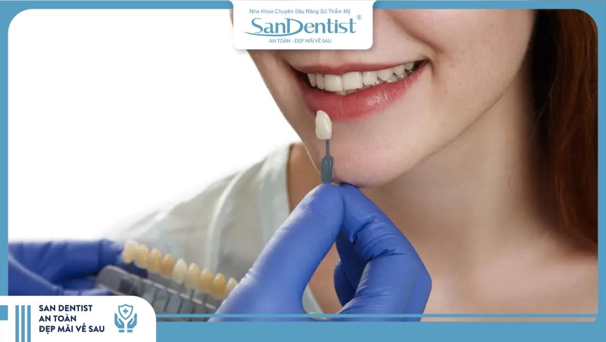 Quy trình dán sứ Veneer