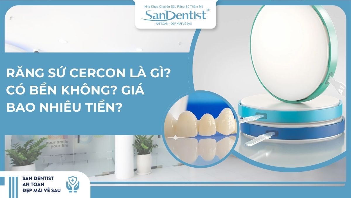 Răng sứ cercon là gì Có bền không Giá bao nhiêu tiền