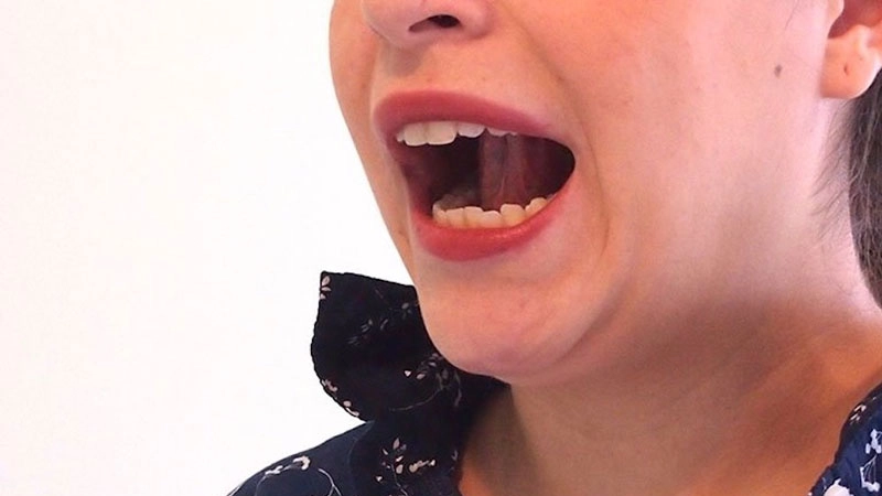 Bài tập há miệng sau khi nhổ răng khôn