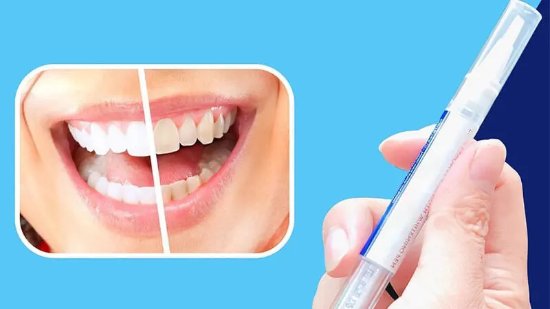 Cách ngăn ngừa tình trạng ê buốt răng