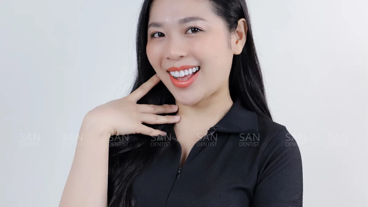 Chi phí bọc răng sứ mới nhất 2024 tại San Dentist