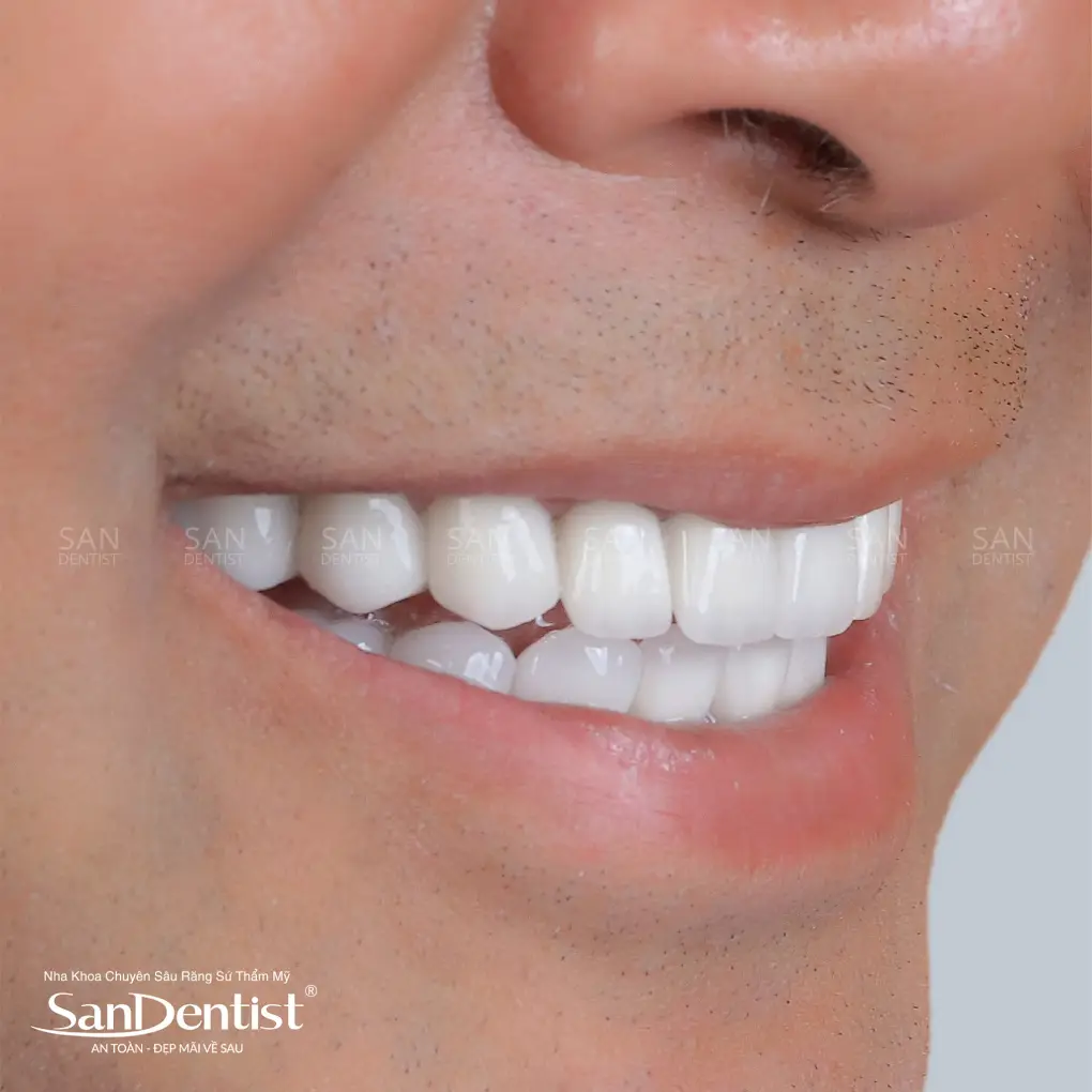 Lồi xương hàm dưới có gây nguy hiểm không?