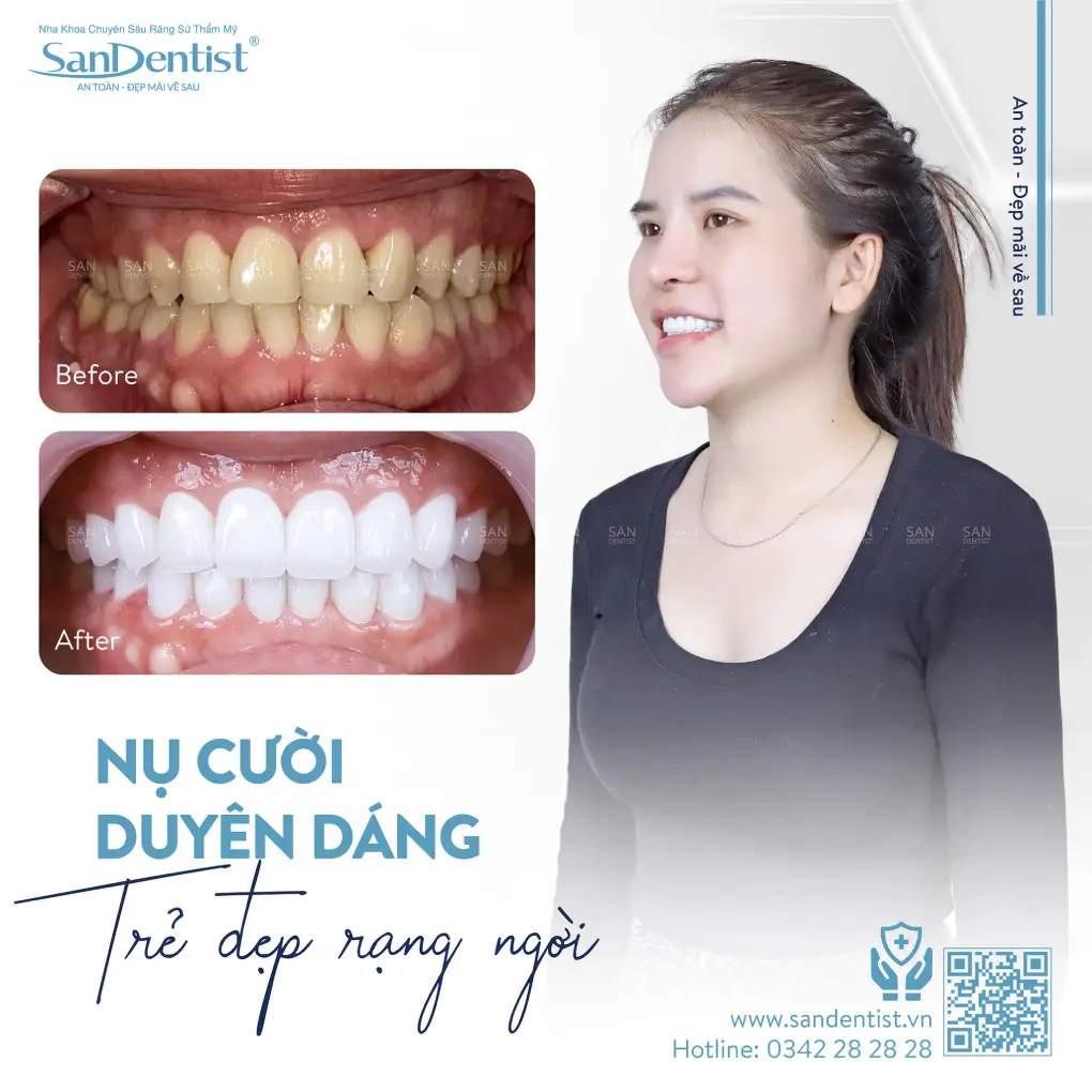 Lồi xương hàm dưới có gây nguy hiểm không?