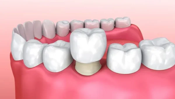 Phủ sứ nano có thật sự hiệu quả?