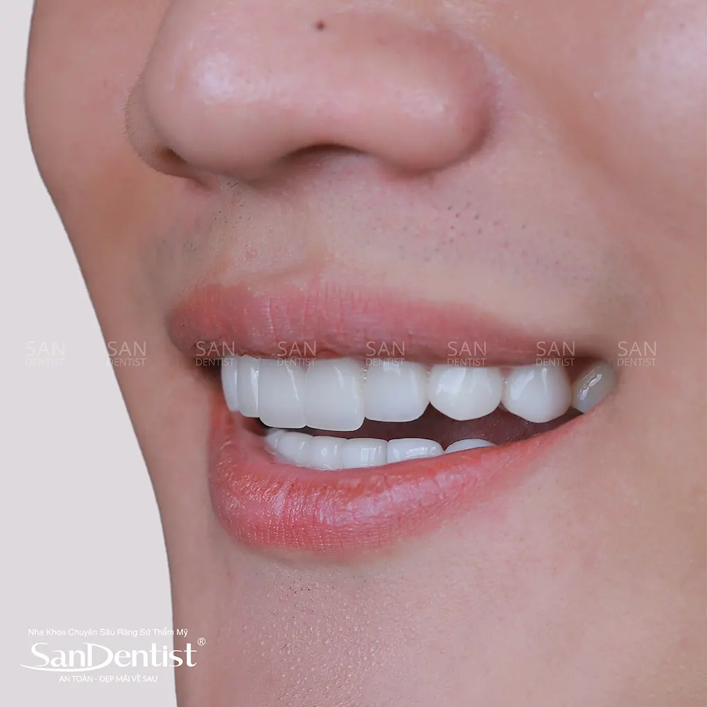 Phủ sứ nano có thật sự hiệu quả?