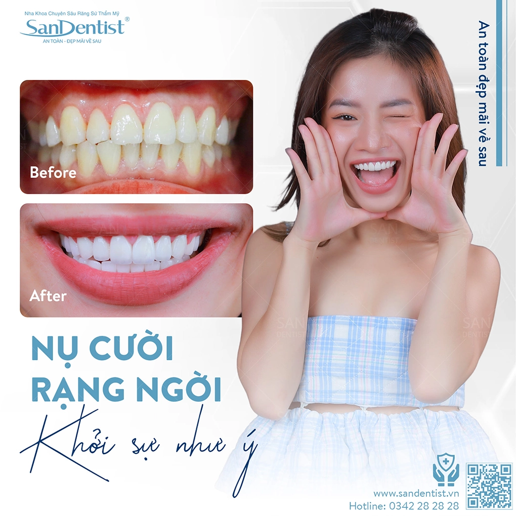 Răng khôn mọc mấy lần trong đời?