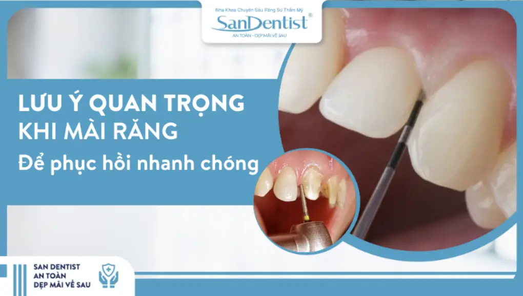Những lưu ý quan trọng sau khi mài răng để phục hồi nhanh chóng