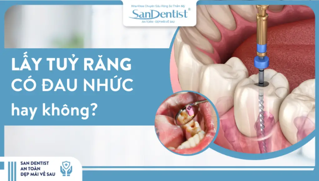 Quá trình lấy tủy răng có đau nhức hay không?