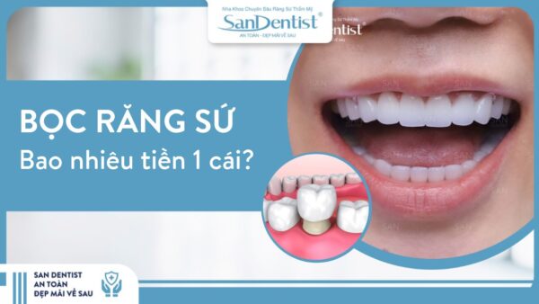 Bọc răng sứ bao nhiêu tiền 1 cái